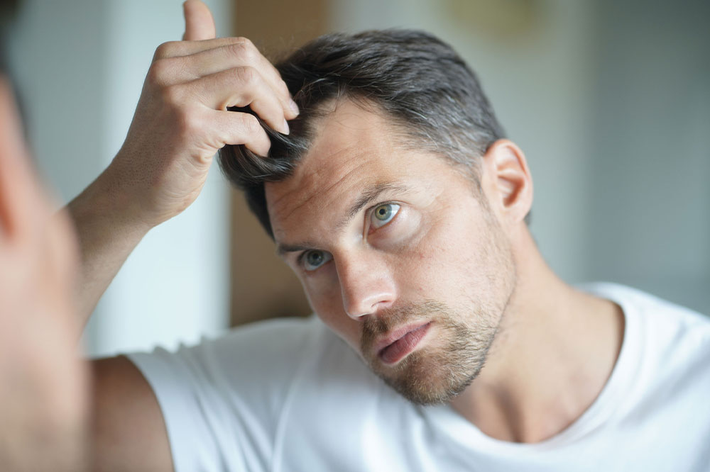 6 Health Conditions That Trigger Severe Hair Loss