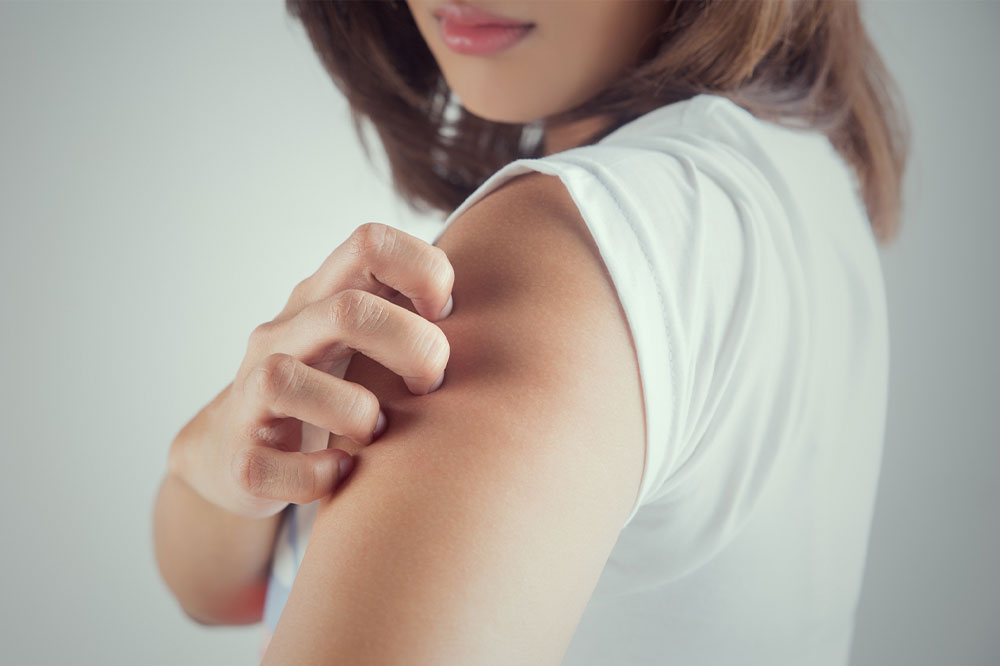 8 common triggers of itchy skin to be aware of