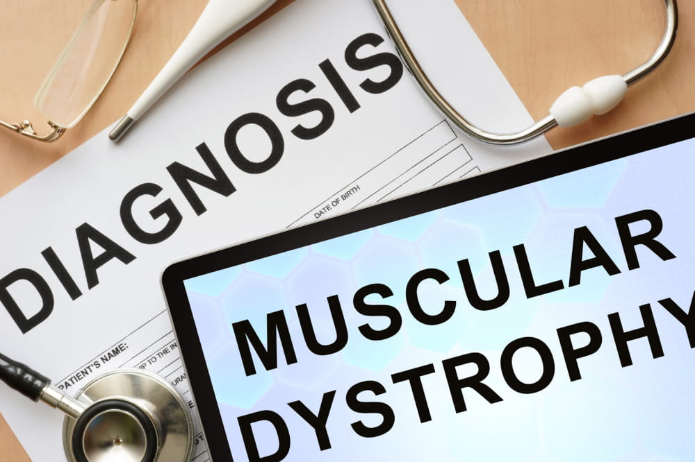 9 common types of muscular dystrophy and their symptoms