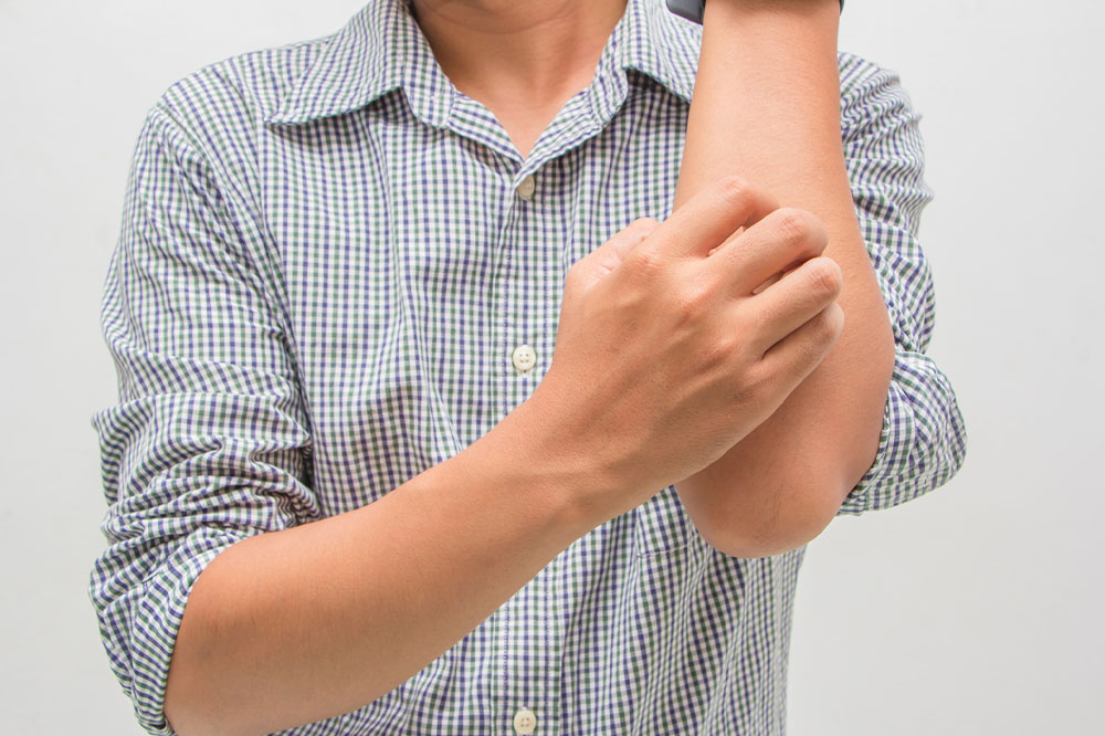 Everything to know about eczema