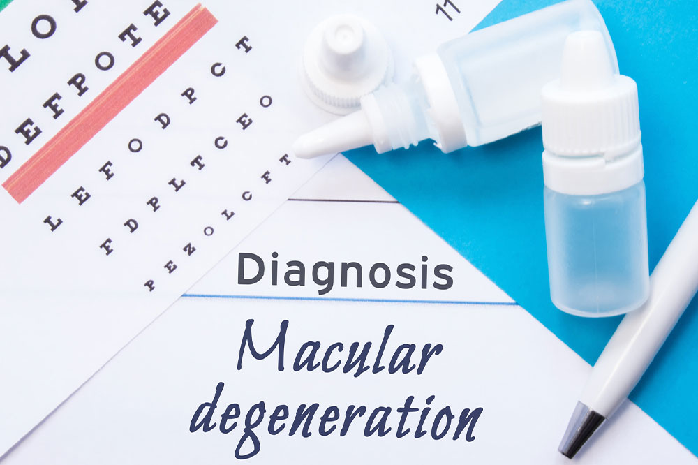 Key things to know about macular degeneration