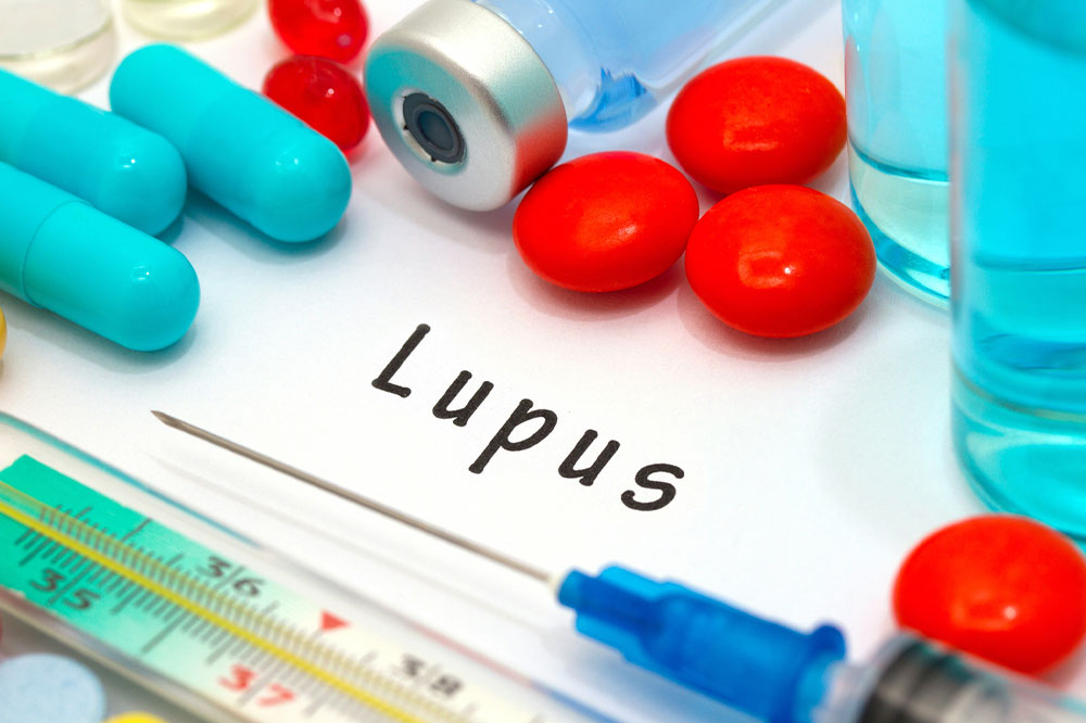 Lupus &#8211; Types and Warning Signs