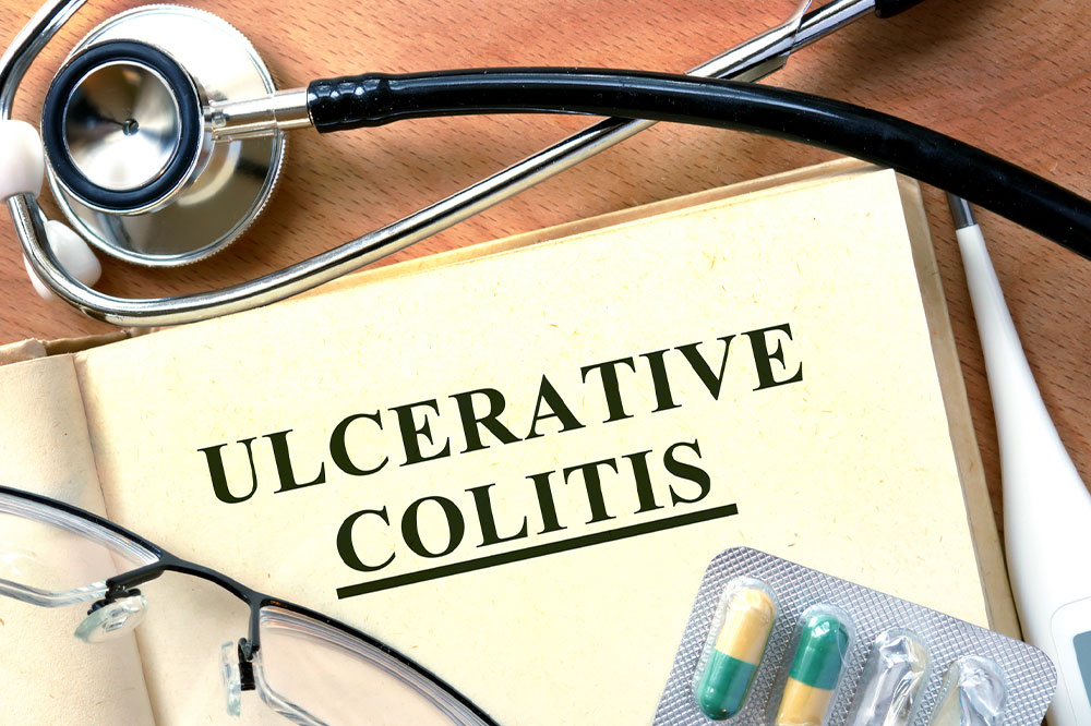 Simple tips for managing ulcerative colitis