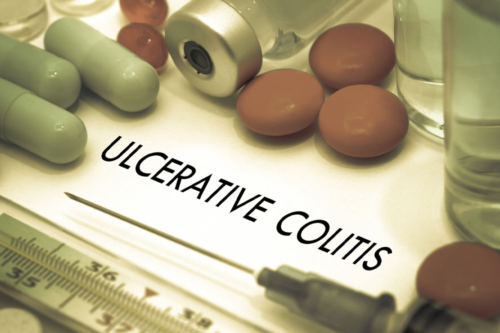 Signs and complications of ulcerative colitis